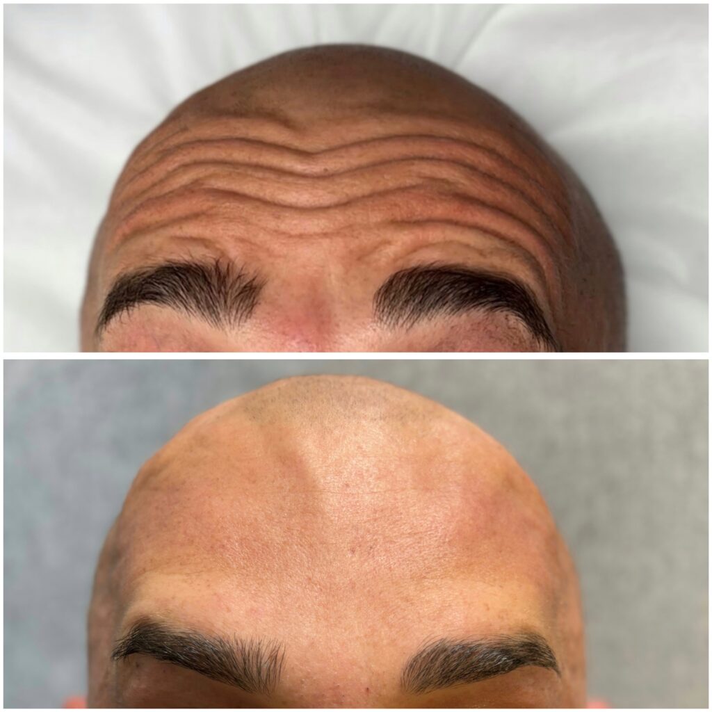 72a38241 916b 490d a2d0 51c34ad5c414